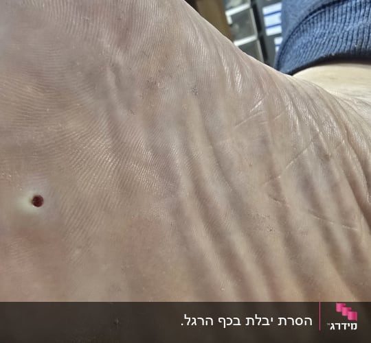 תקריב של כף רגל עם סימן כהה